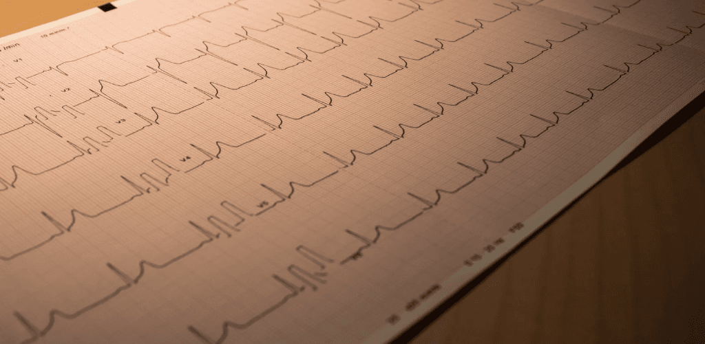 The Cardiology Pack Is Here — 12 Cases That Will Change How You Think About Chest Pain