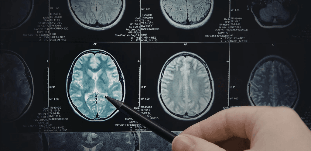 Sniper Mechanic, Lethal Traps, and Stabilize Mode: How MedDiagnosis Teaches Clinical Reasoning